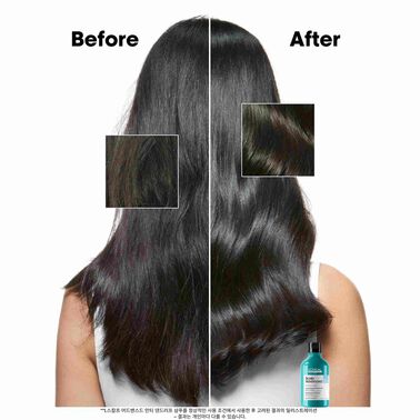 안티 댄드러프 샴푸 - 로레알 프로페셔널 | L'Oréal Partner Shop